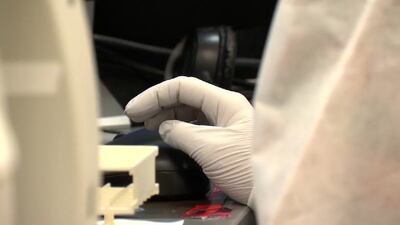 OHSU researchers make breakthrough in tuberculosis vaccine