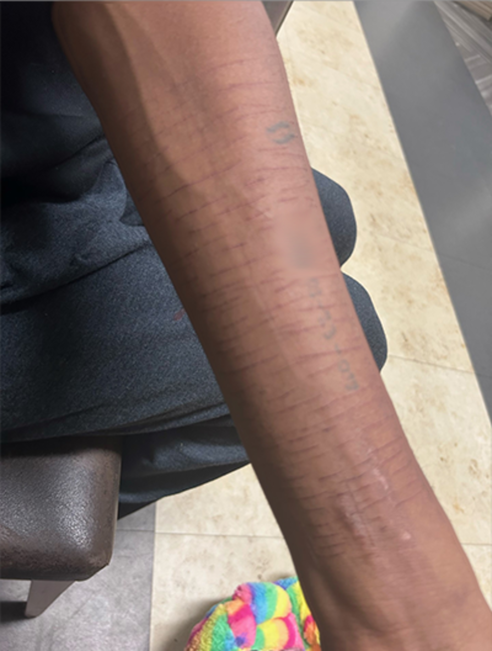 Student's scars from cuts he did to himself