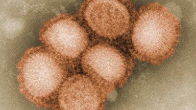 A school in Texas has closed for a few days due to widespread flu.