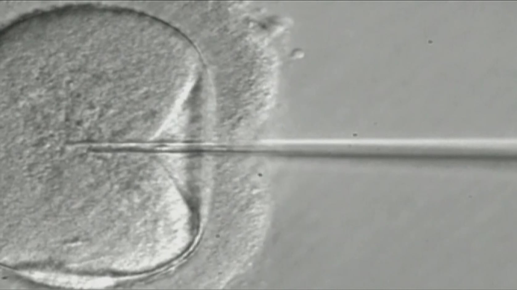 IVF bill reactions