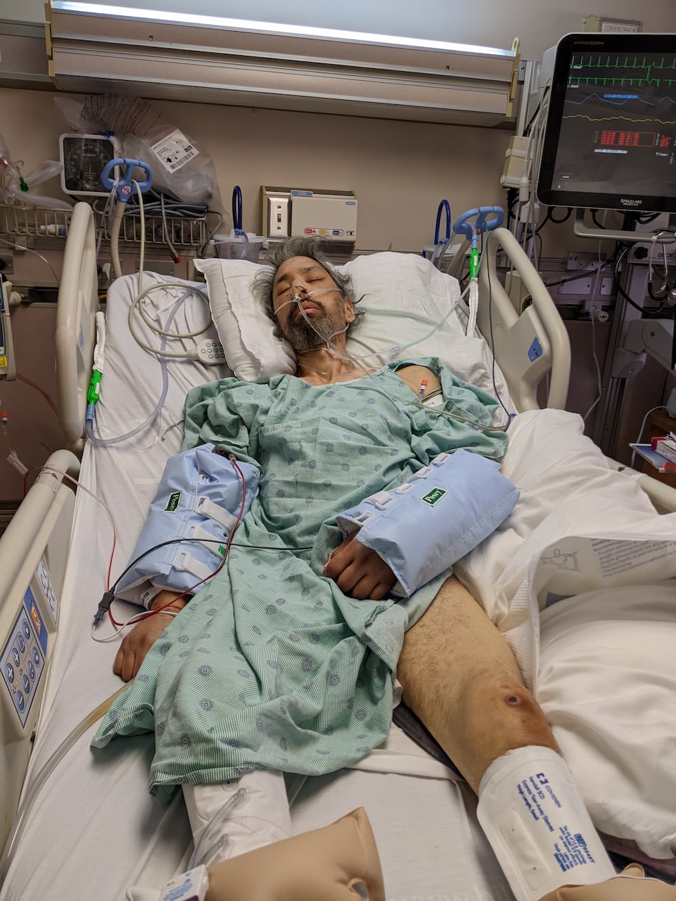 Alan Thibodeau was itted to the hospital after being held in the Bamberg County Detention...