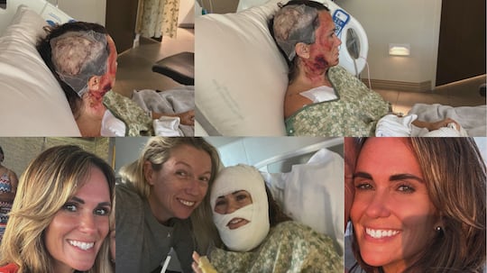 Women suffers third-degree burns in Forsyth Park acid attack; Community concerned