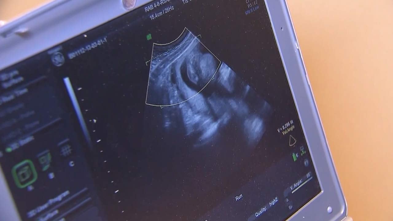 The South Carolina Supreme Court will hear a challenge to the state's six-week abortion ban...