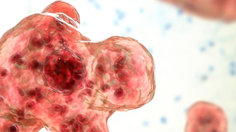 The patient likely got the Naegleria fowleri infection – which destroys brain tissue, causing...