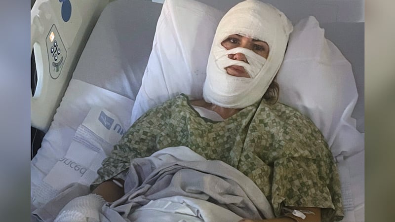 In this photo provided by Connor Milam, her friend Ashley Wasielewski sits with bandages in a...